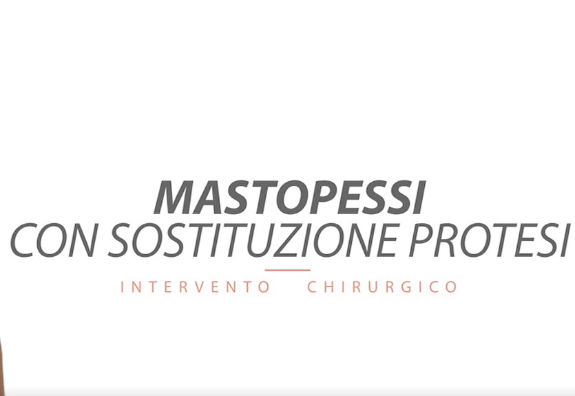 In sala operatoria con il Dr. Massimo Di Giuli: Mastopessi con sostituzione protesi